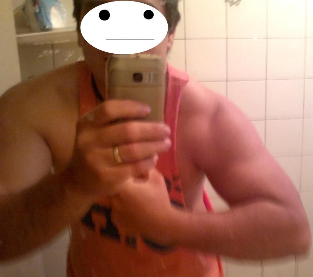 hipertro10.jpg